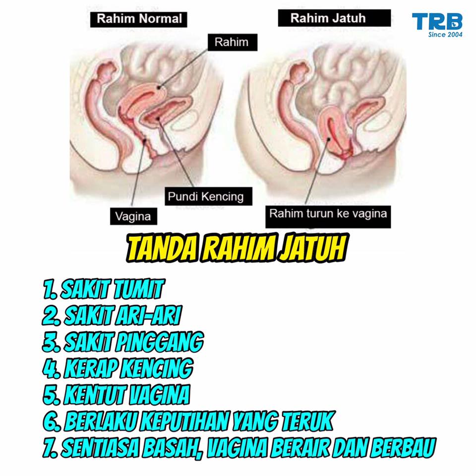 Cahaya Mata Awasss Tanda2 Rahim Jatuh Follow Ig Facebook