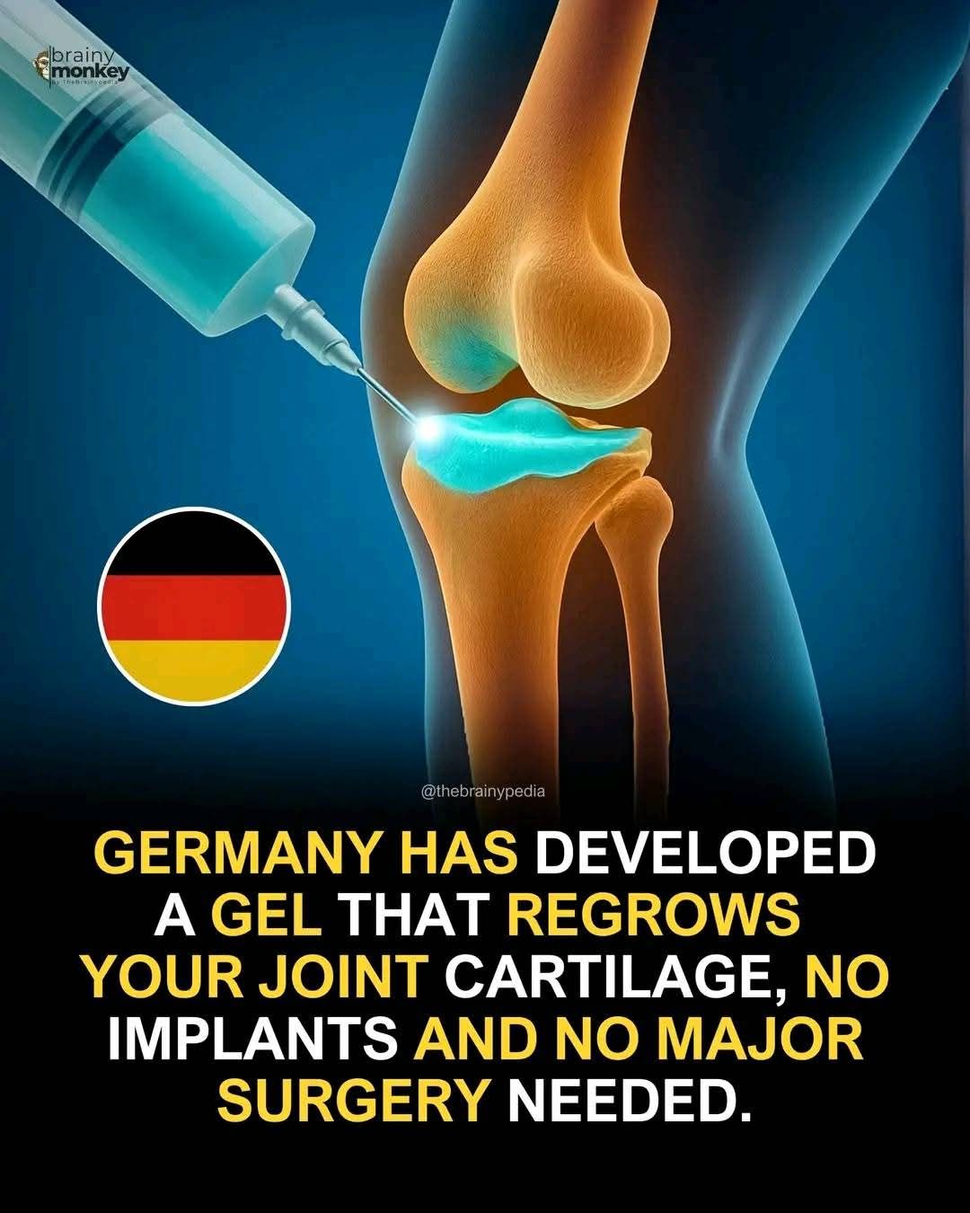 can bpc 157 regrow cartilage After years of taking care of joints, bones, muscles, and tendons, I've learned that recovery doesn't end when surgery is over or physical therapy starts. One of the most common questions my BPC-157 or Stem Cells For
