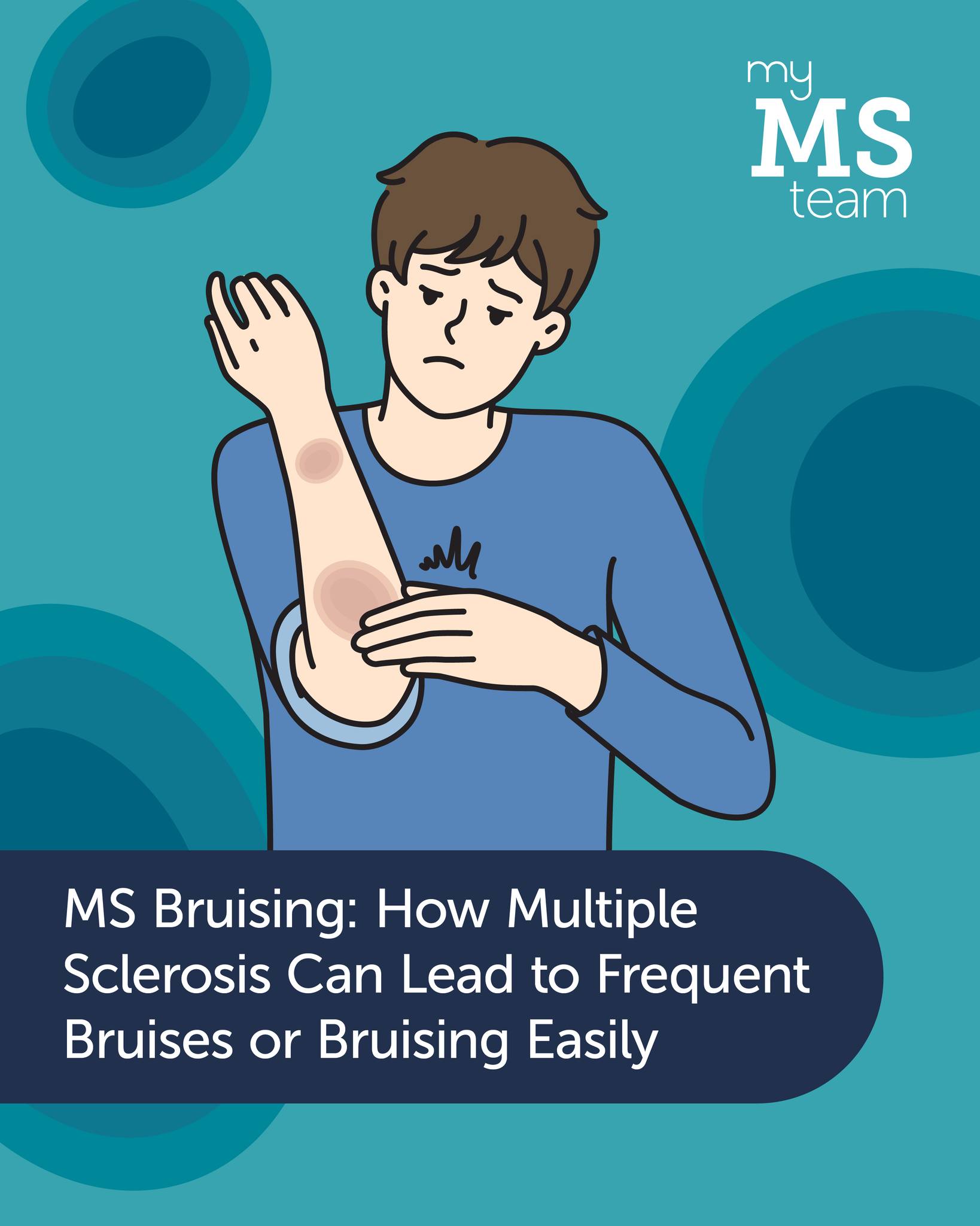 MyMSTeam - Some people living with #MultipleSclerosis... | Facebook