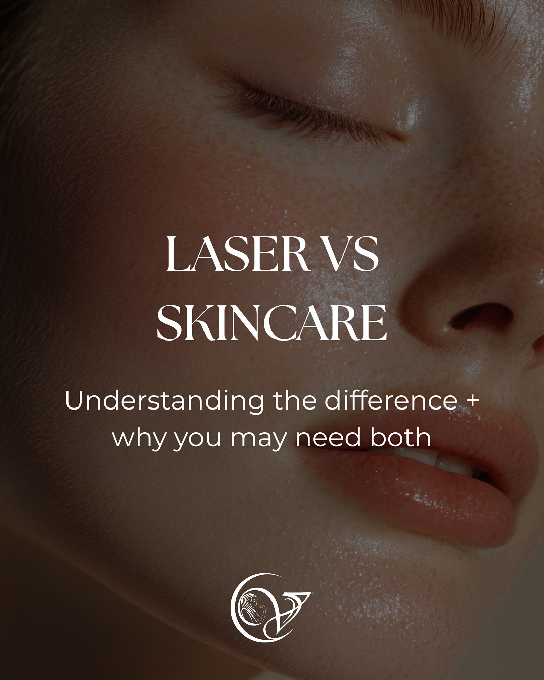Laser vs. Skincare: Which... - Vitality Anti Aging Center | Facebook
