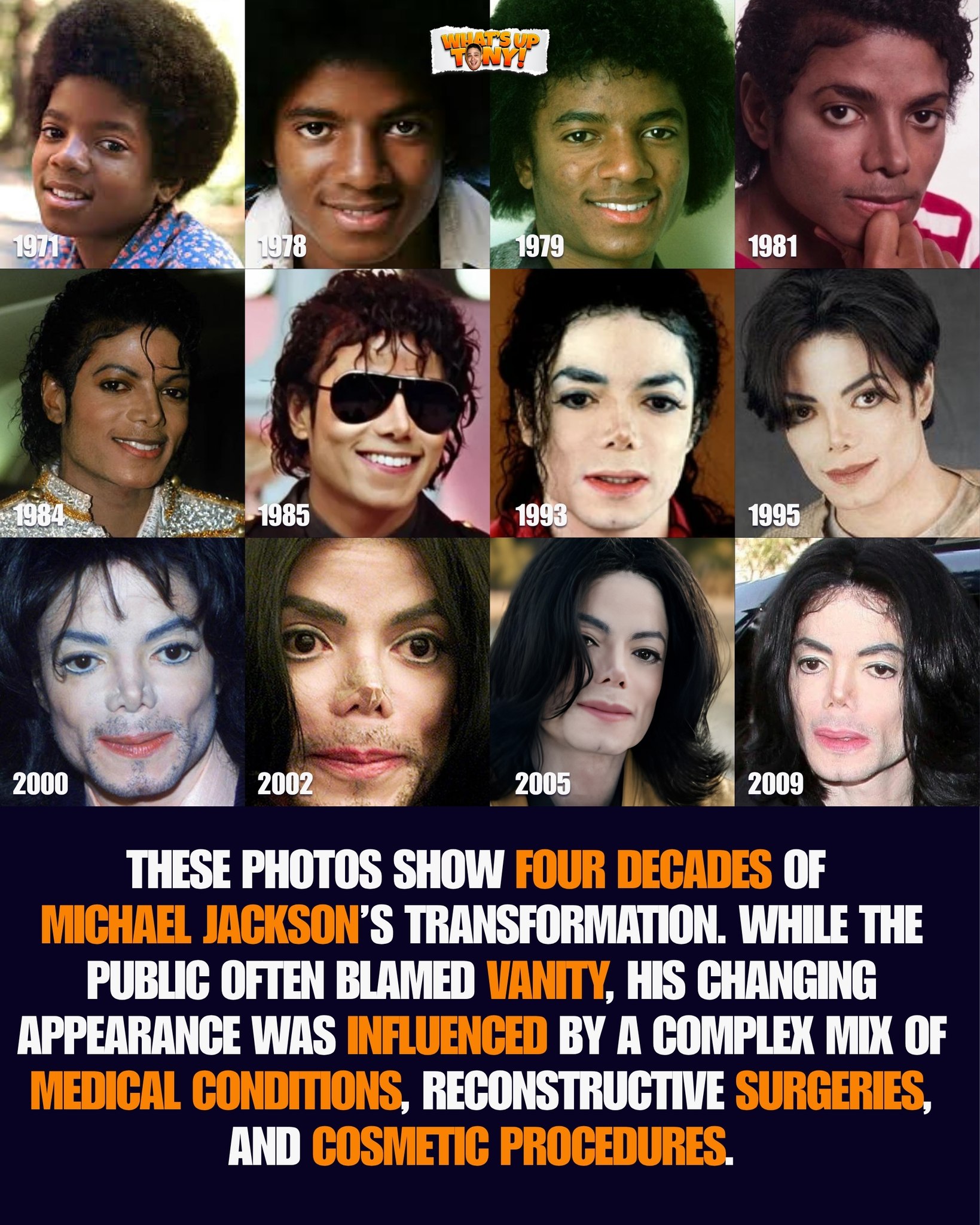 The evolution of Michael Jackson's face from 1971 to 2009.