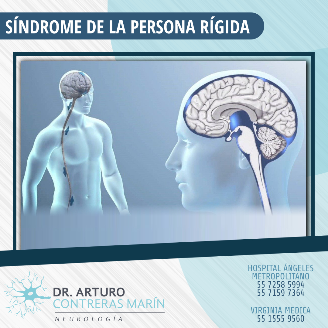 SÍNDROME DE LA PERSONA RÍGIDA... - Dr. Arturo Contreras Marín