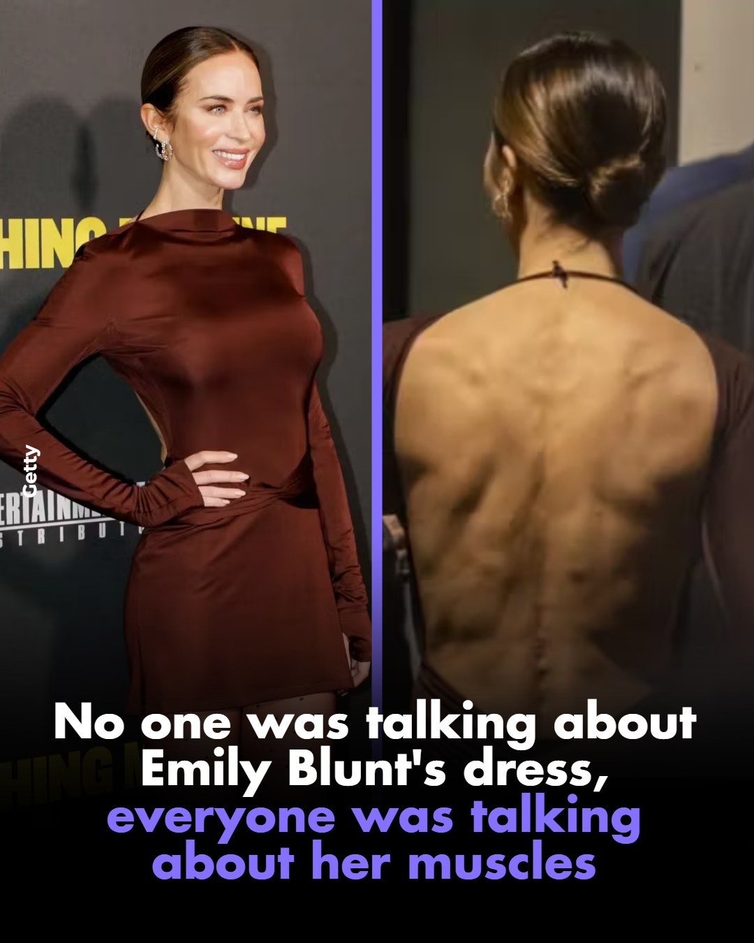 backless dress actress A back-baring image was enough to get social media talking. The appeared in a dress, and her physique immediately drew attention, especially the definition in her shoulders, arms, and back Color:WINE size-3xl Ever New Andie Satin