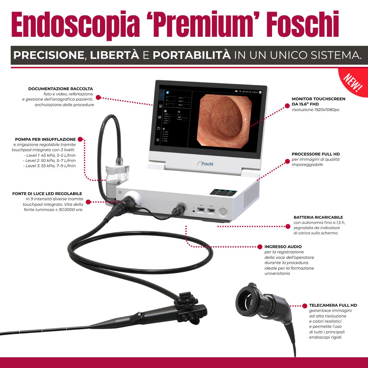 Foschi - 🔴 𝗘𝗻𝗱𝗼𝘀𝗰𝗼𝗽𝗶𝗮 𝗣𝗿𝗲𝗺𝗶𝘂𝗺 𝗙𝗼𝘀𝗰𝗵𝗶: 𝗽𝗿𝗲𝗰𝗶𝘀𝗶𝗼𝗻𝗲, 𝗹𝗶𝗯𝗲𝗿𝘁𝗮̀... | Facebook