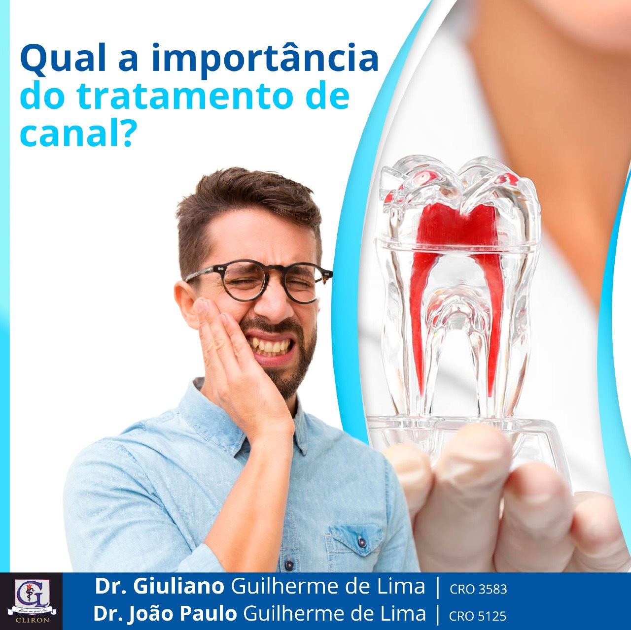 Clínica Cliron - Tratamento de canal, também conhecido...