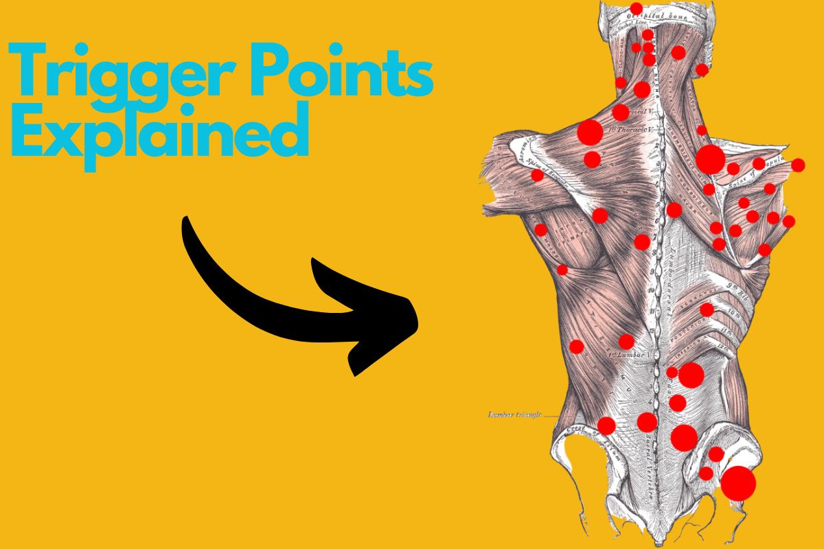 Christian - Trigger Points - we hear a lot about them and how they can ...