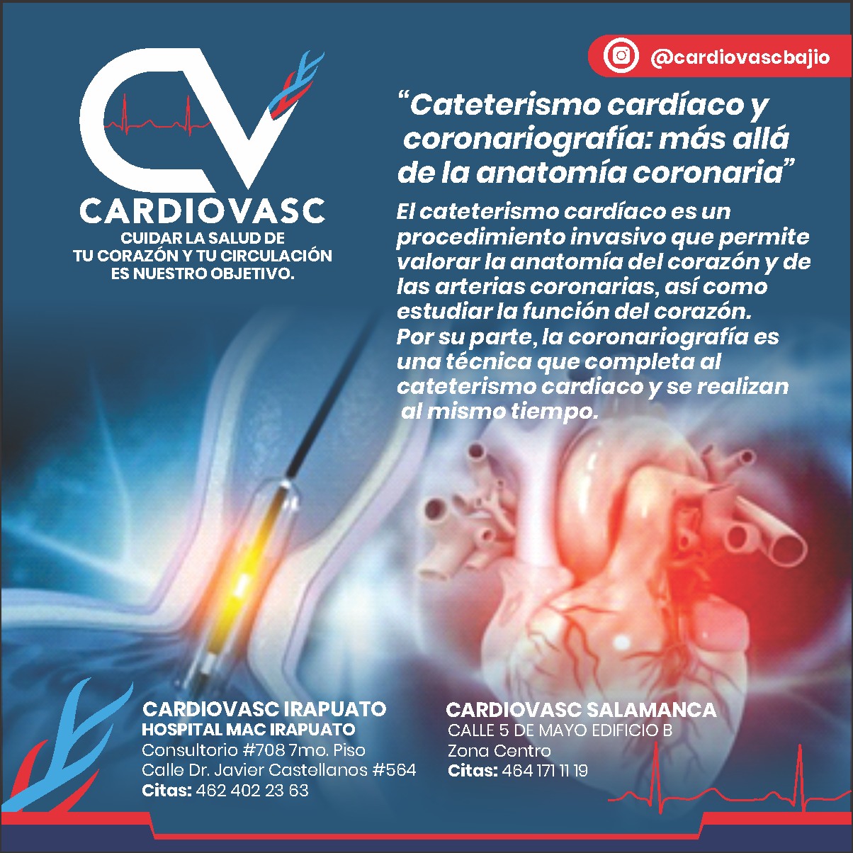 Cardiovasc - 🧐¿Qué es un cateterismo cardíaco🫀? El cateterismo cardíaco ...