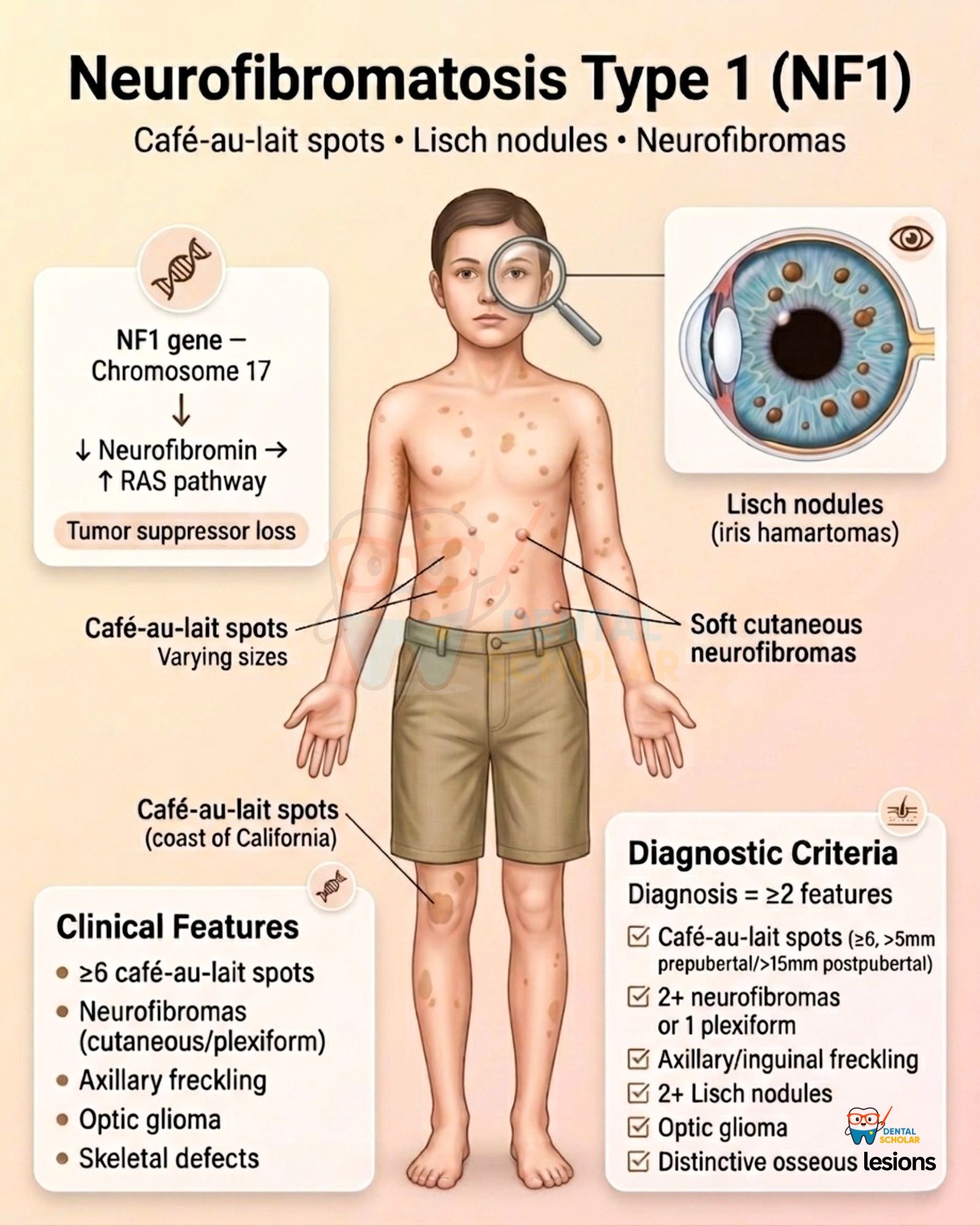 neurofibromotosis glutathione What are cafe-au-lait marks and their relation to neurofibromatosis? MTHFR Gene Mutation Treatment Gummies:50 Gummies grade