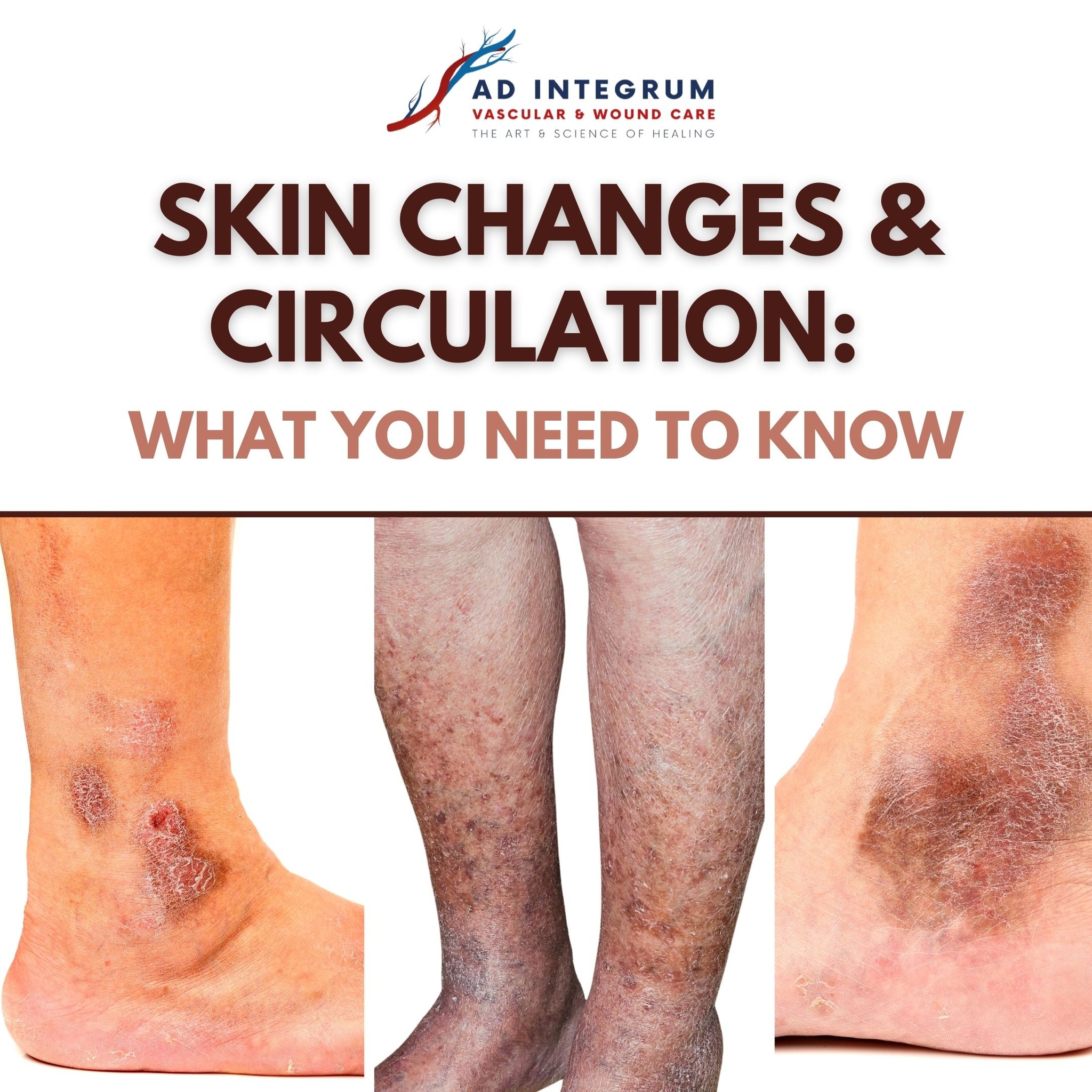 What does your skin... - Ad Integrum Vascular & Wound Care | Facebook