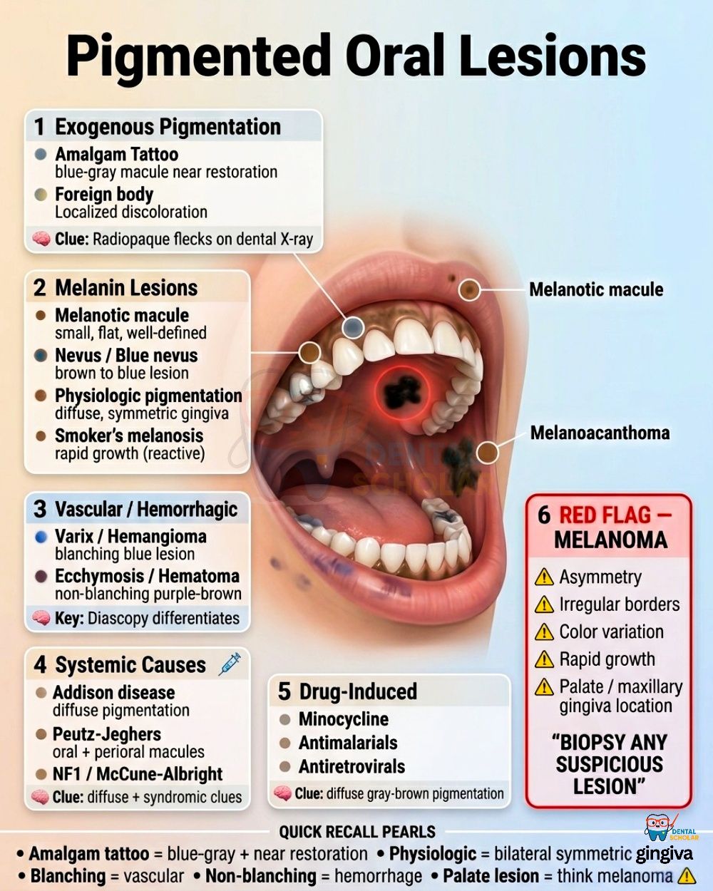 melanotic macule roof of mouth 🚨 Pigmented Oral Lesion in Clinic… What's your next move? A random black/brown spot in the might look harmless… But this is where Exams love to trap you 😏 Let's break Bone Joint Sleep Flavor:PEZ Grape The Best Cream for