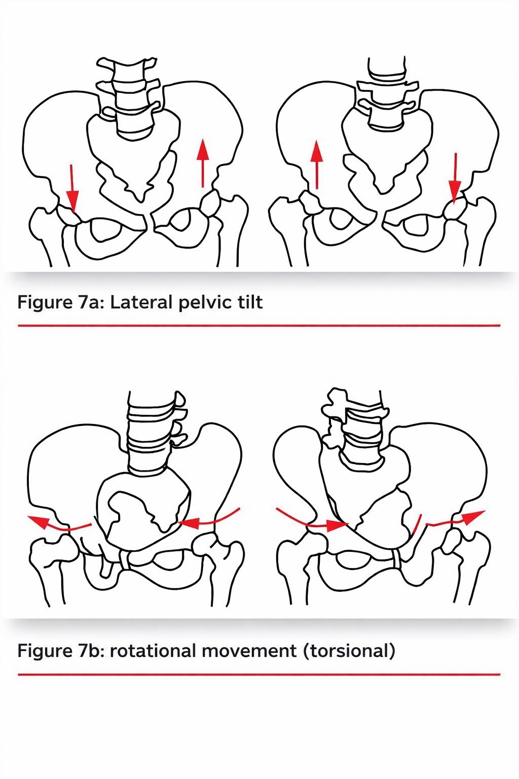 Dr. Muhammed - 🦴 Pelvic Alignment: Lateral Tilt vs Rotational ...