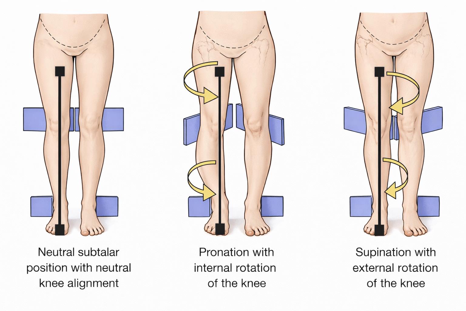 🦶 Foot Mechanics & Knee Alignment... - Dr. Muhammed Ziya | Facebook