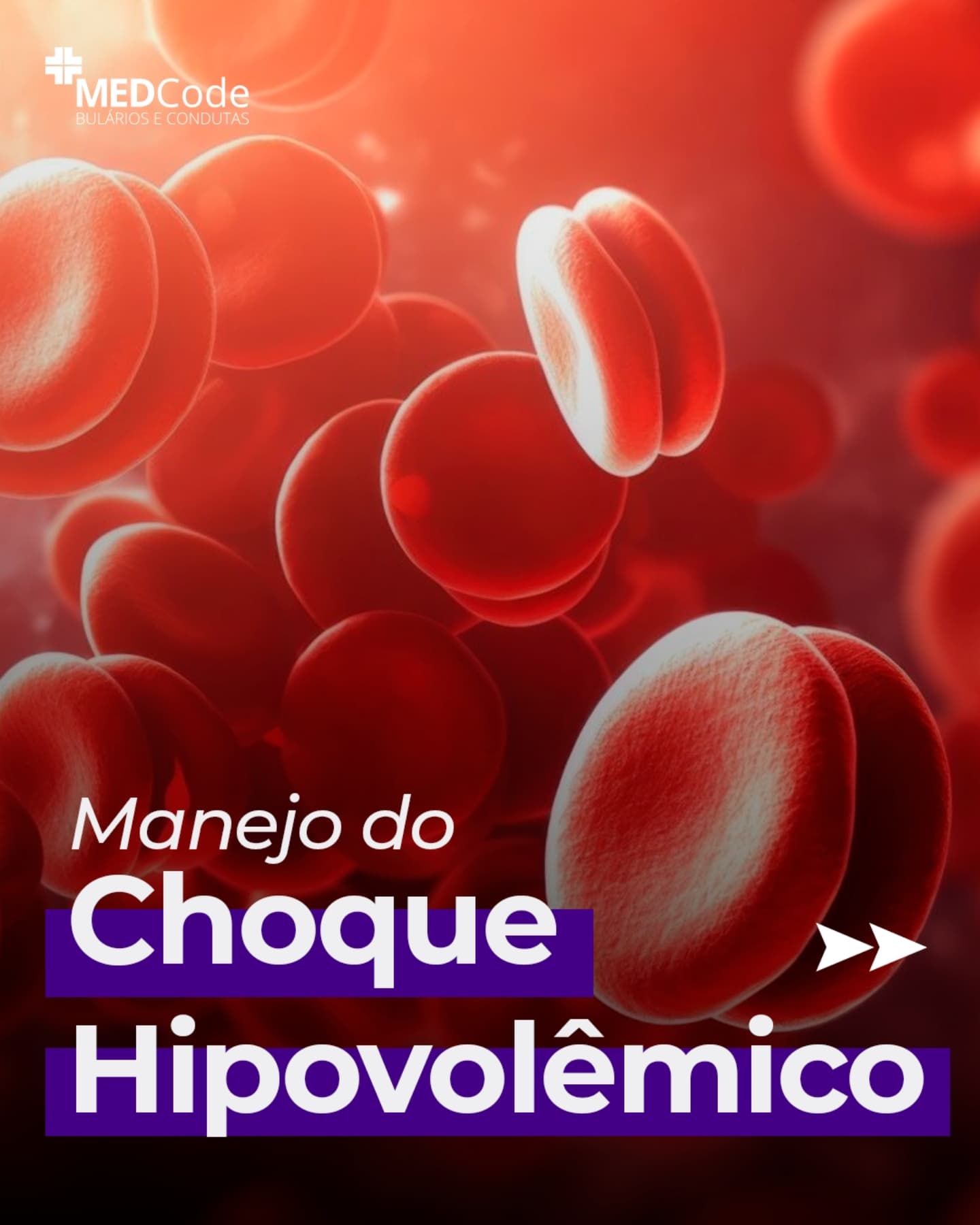 🔴 Choque hipovolêmico: como... - MEDCode: Bulários e Condutas | Facebook