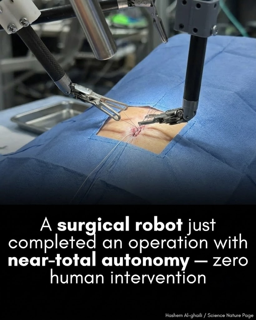 A robot guided by an AI just performed surgery with near-perfect