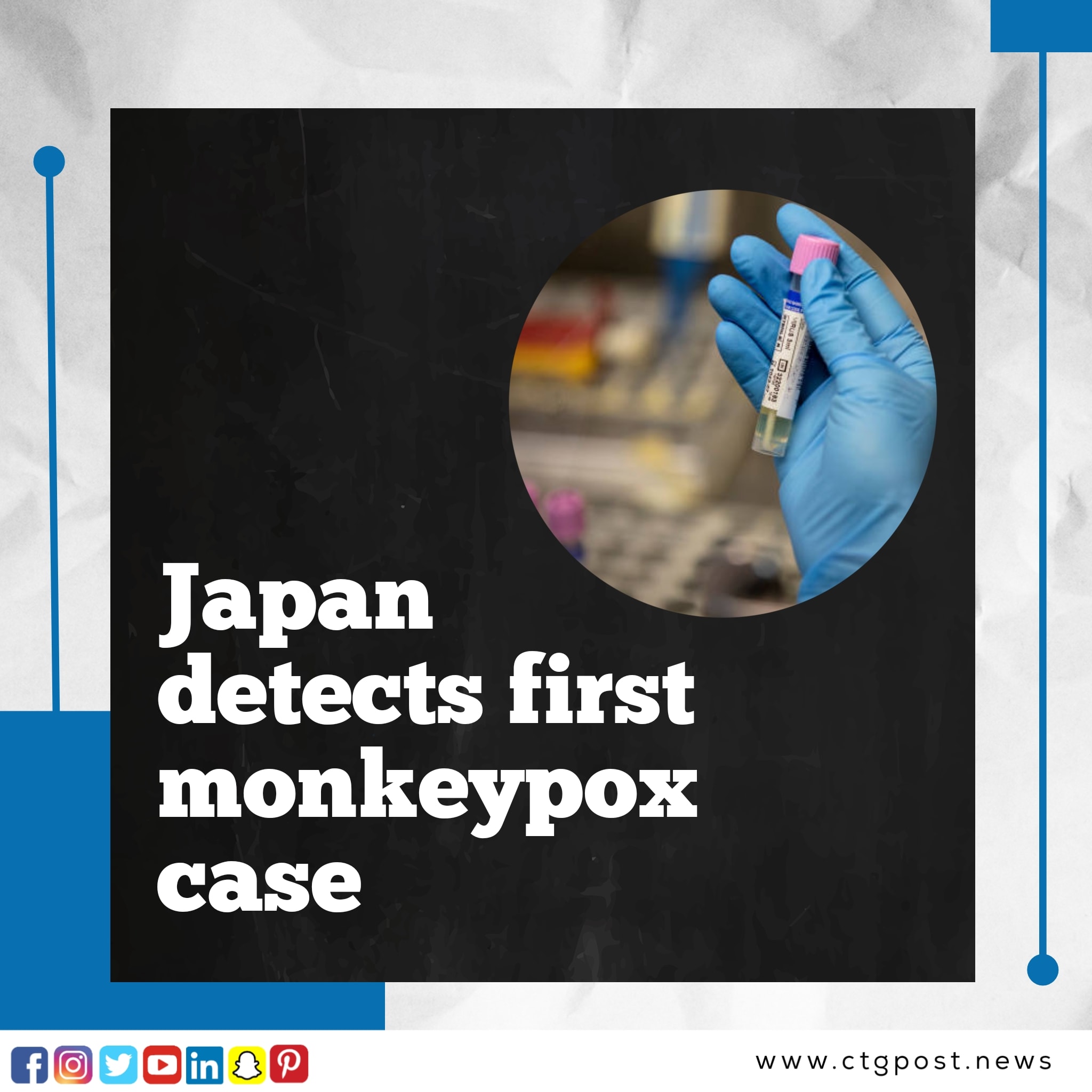 Ctgpost.news - Japan on Monday confirmed its first case of monkeypox ...