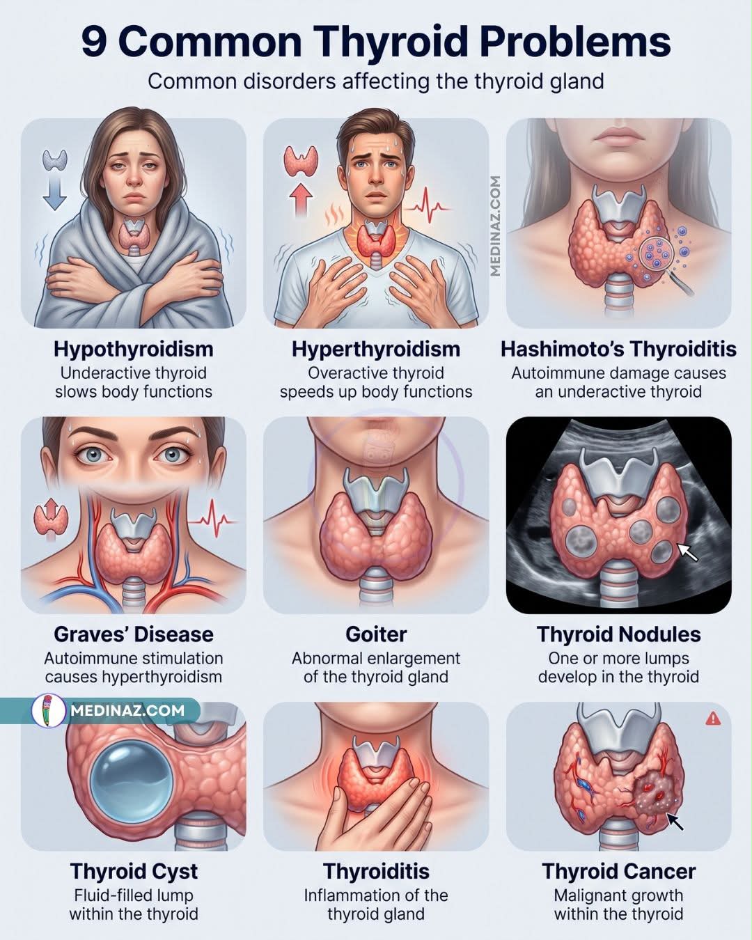 What to do about persistent neck lump and thyroiditis symptoms?