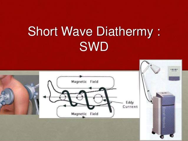 يومك - #Short_Wave_Diathermy 