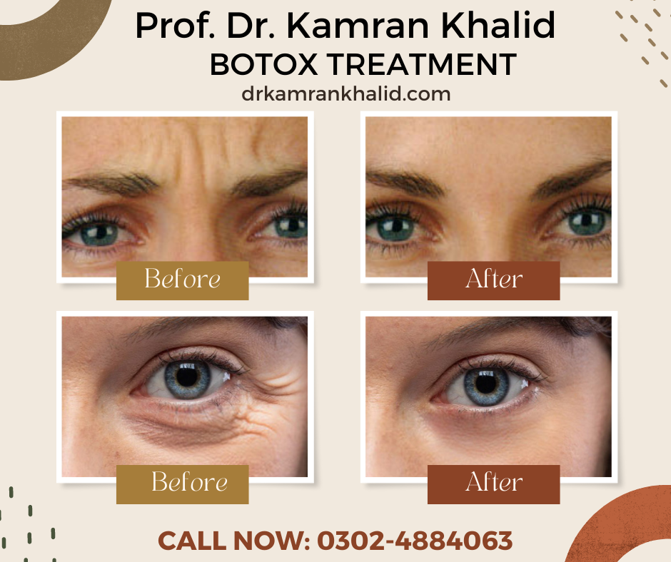 Botox Injection is the most... - Prof. Dr. Kamran Khalid | Facebook