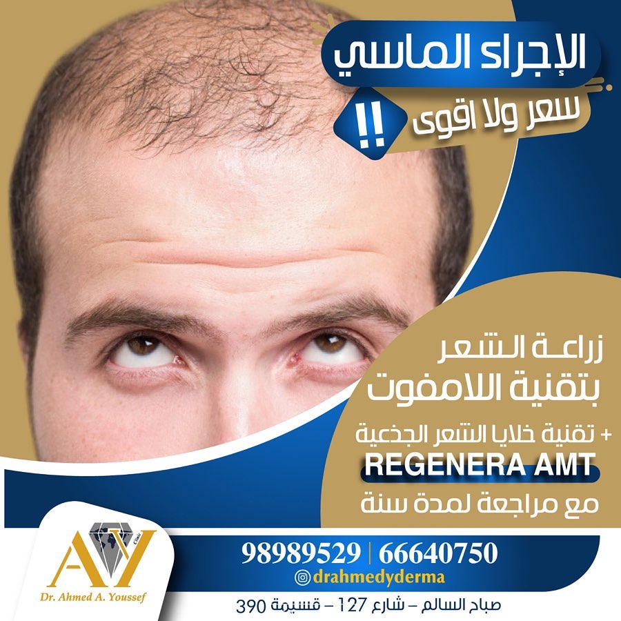 اسأل عن احدث تقنية لزراعة الشعر بتقنية اللامفوت بدون ألم بدون تورم و خاصة بدون حلاقة الرأس للنساء بالإضافة إلى تقنية الخلايا الجذعية Amt Regenera الأحدث بالعالم في النساء