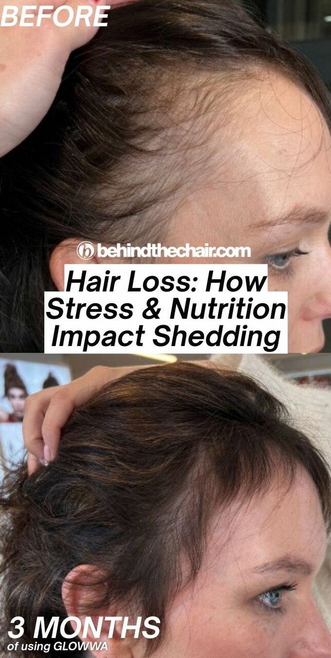 Hairstylists: Here's What You Really Need To Know About Hair Loss... https://behindthechair.com/articles/what-hairstylists-should-know-about- hair-loss