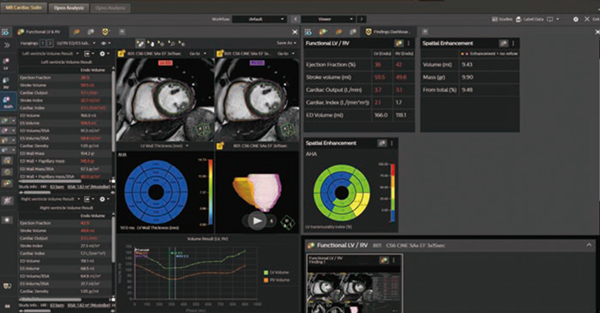 インナービジョン - inNavi Suite技術解説（Precision Medicine時代のCardiac Imaging 2025 ...