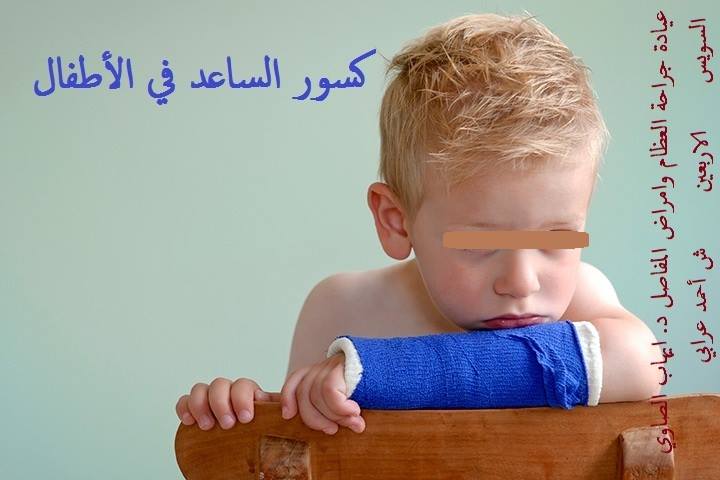 ‫كسور الساعد في الأطفال الساعد هو جزء من&hellip; عيادة جراحة العظام وامراض