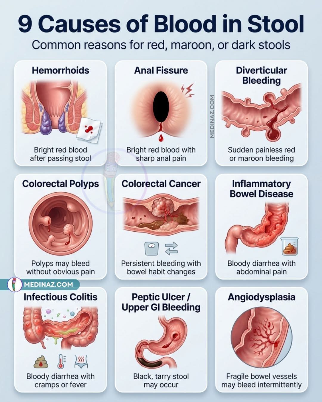 Blood in stool and hospital stay needed
