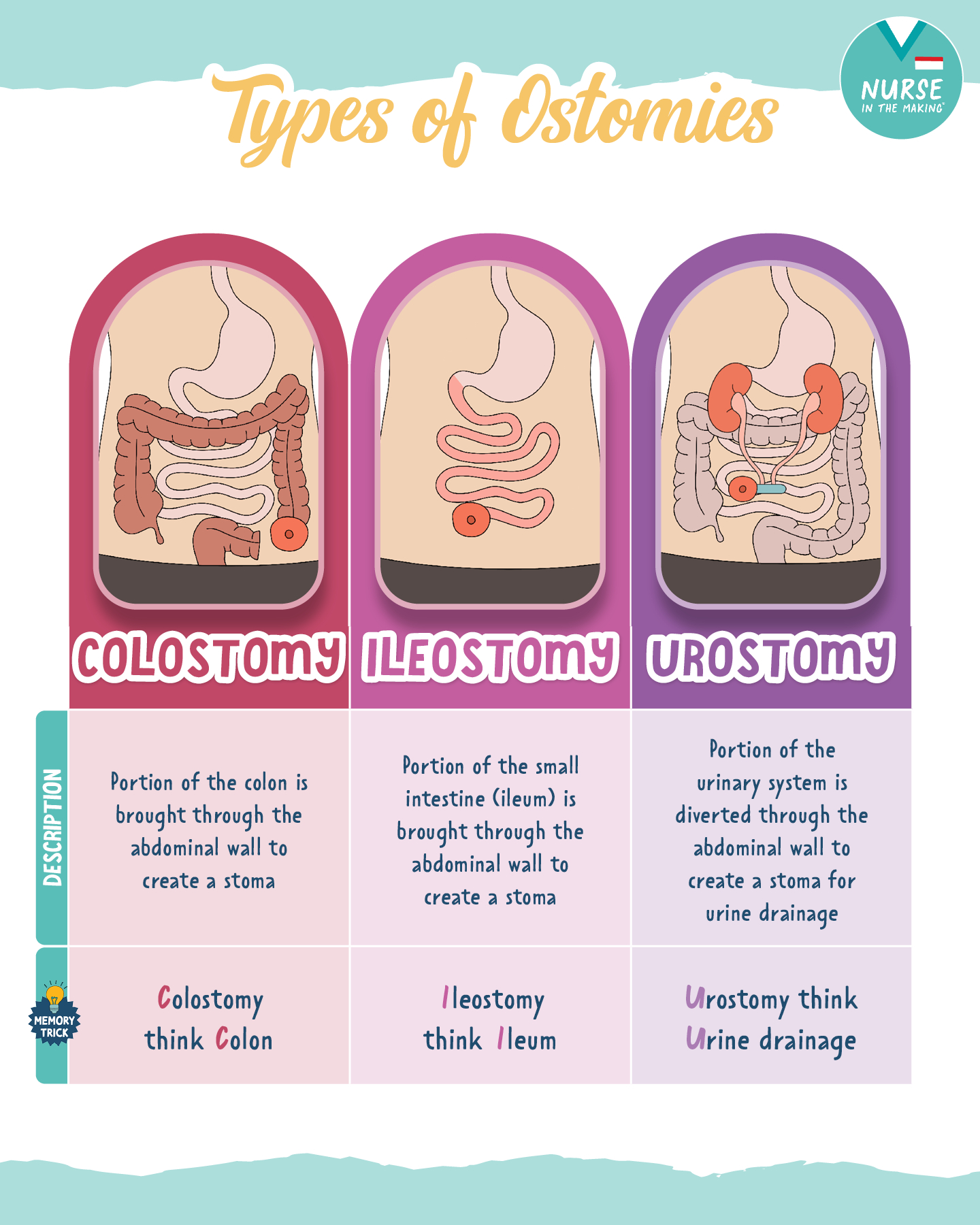 What is an Ostomy? 🩺 An ostomy is a... - Nurse In The Making | Facebook