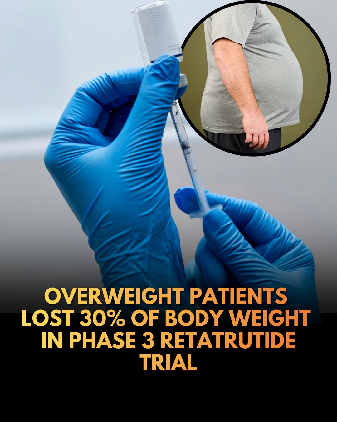 A new weight loss drug known as Retatrutide is helping patients lose big pounds. But it's not approved by the FDA yet, so people are finding it online. Dr. Christopher McGowan explains