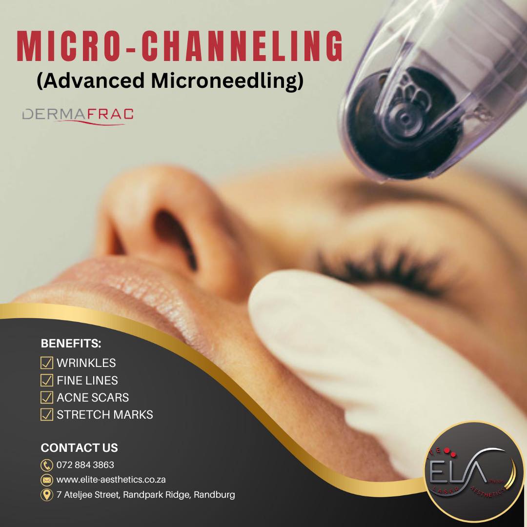 Breakthrough Micro-channeling... - Elite Laser Aesthetics | Facebook