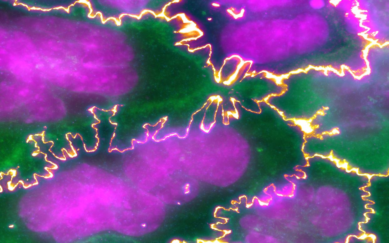 Atcc Cell Line ,Chemical disruption of the pyroptotic pore-forming protein gasdermin D inhibits inflammatory cell death and sepsis