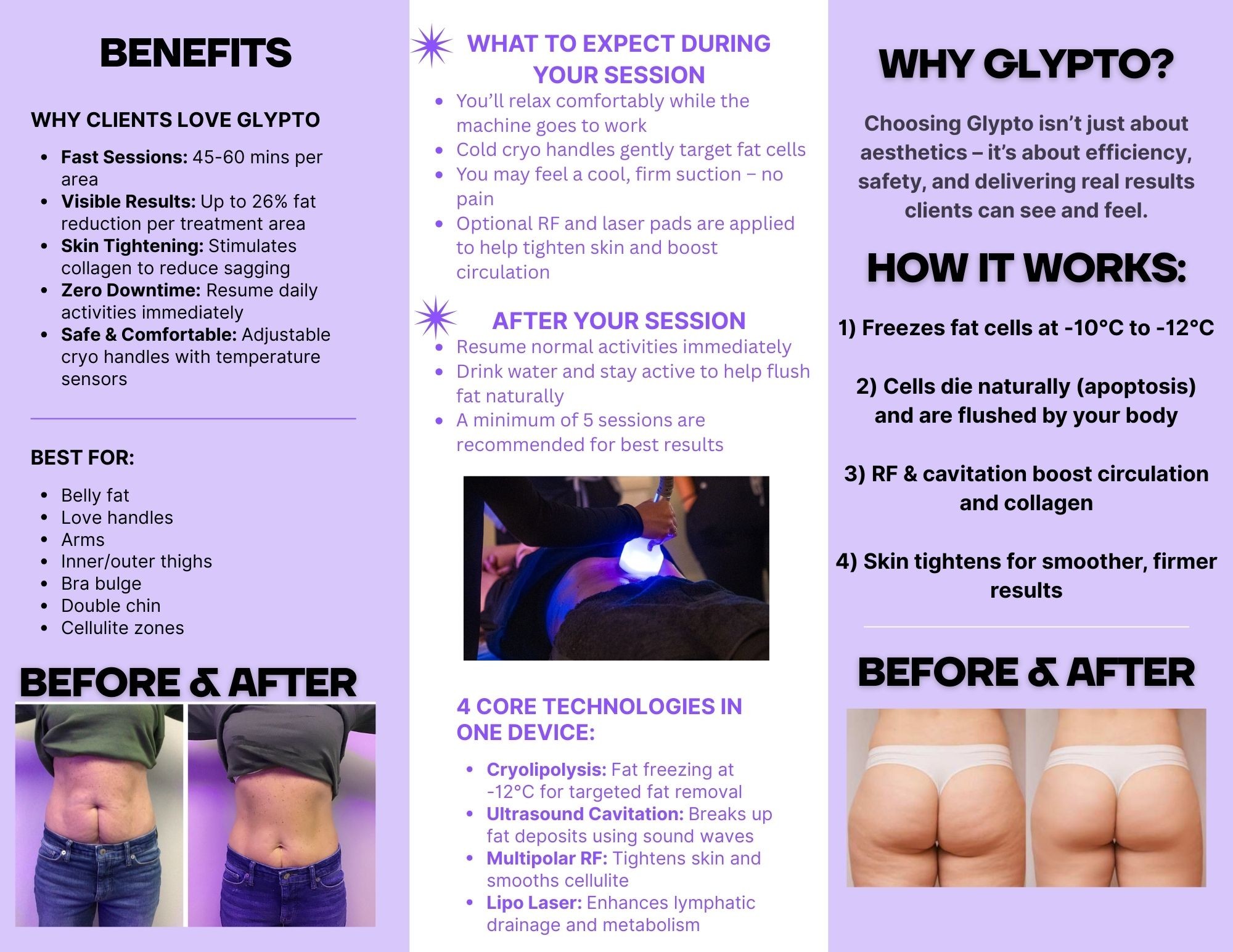 lipo c cypress Glypto Event at Calmer U Cryo Therapy, EMS, RF for Body Sculpting, Face, Chin & Neck. EVENT SPECIAL - $99!!! 2 spots still available for today Flavor:Arctic Snow Cone Glutathione for Hair Growth: Hudvård