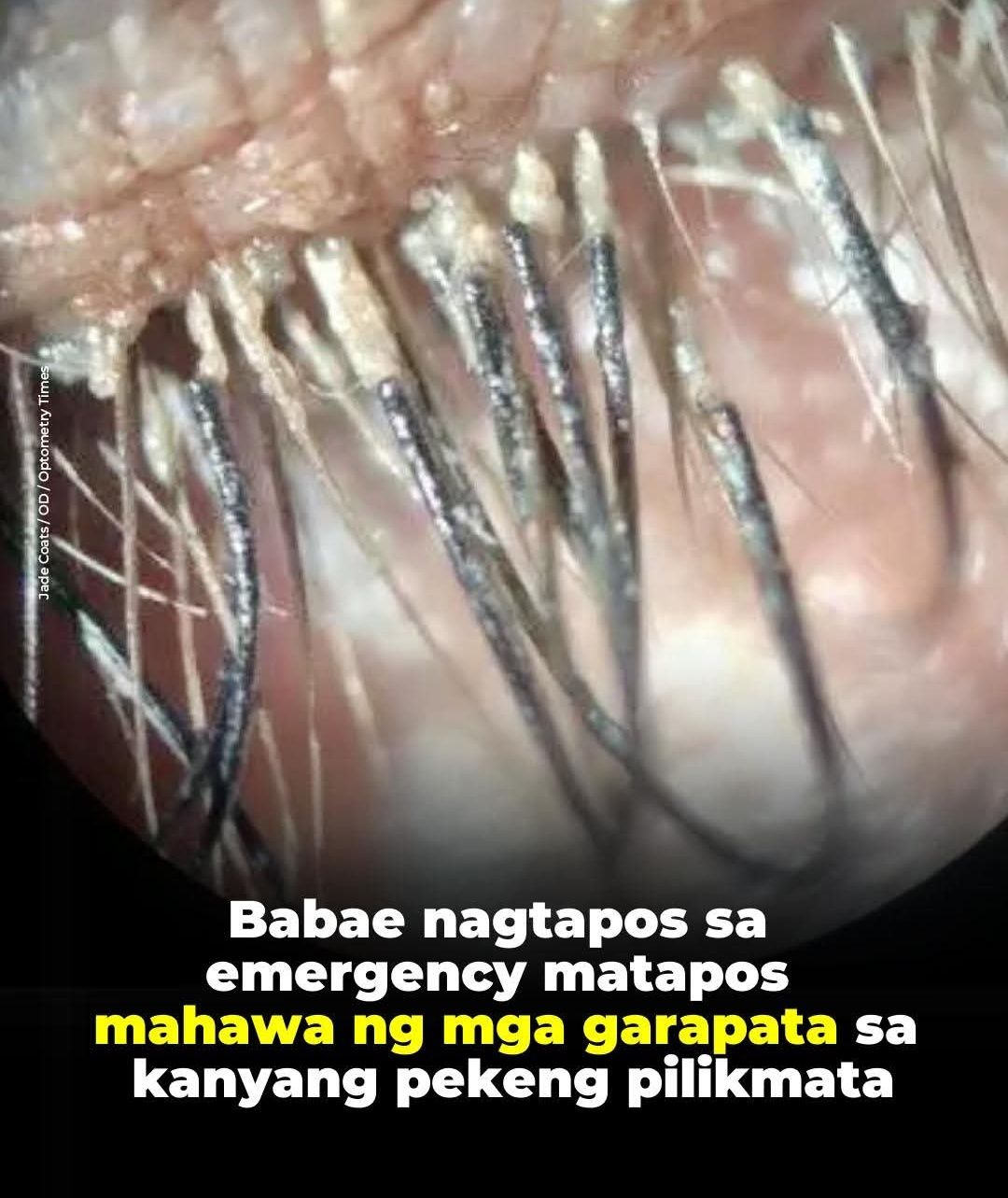 Ishiyama - Isang babae ang nagpunta sa emergency room dahil sa pamumula ...