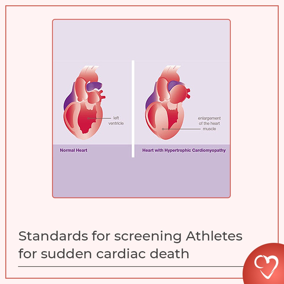 CardioVisual - Hypertrophic obstructive cardiomyopathy (HOCM) is the ...