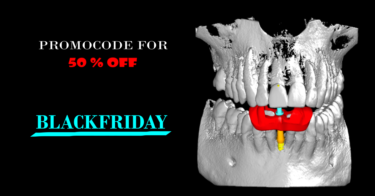 ImplaStation - 💣 BLACK FRIDAY 💣 !!! has started!!! Get🔸... | Facebook