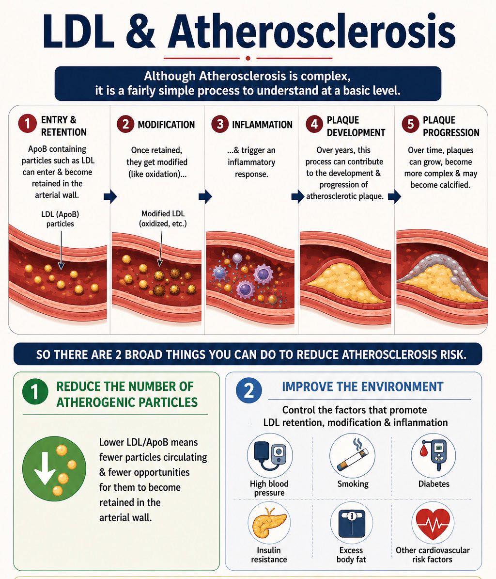 Atherosclerosis sounds complicated, but the basics are simple. LDL/ApoB particles slip into the artery wall, get stuck, become damaged, and trigger inflammation. Do this for years → plaque builds, grows, and hardens