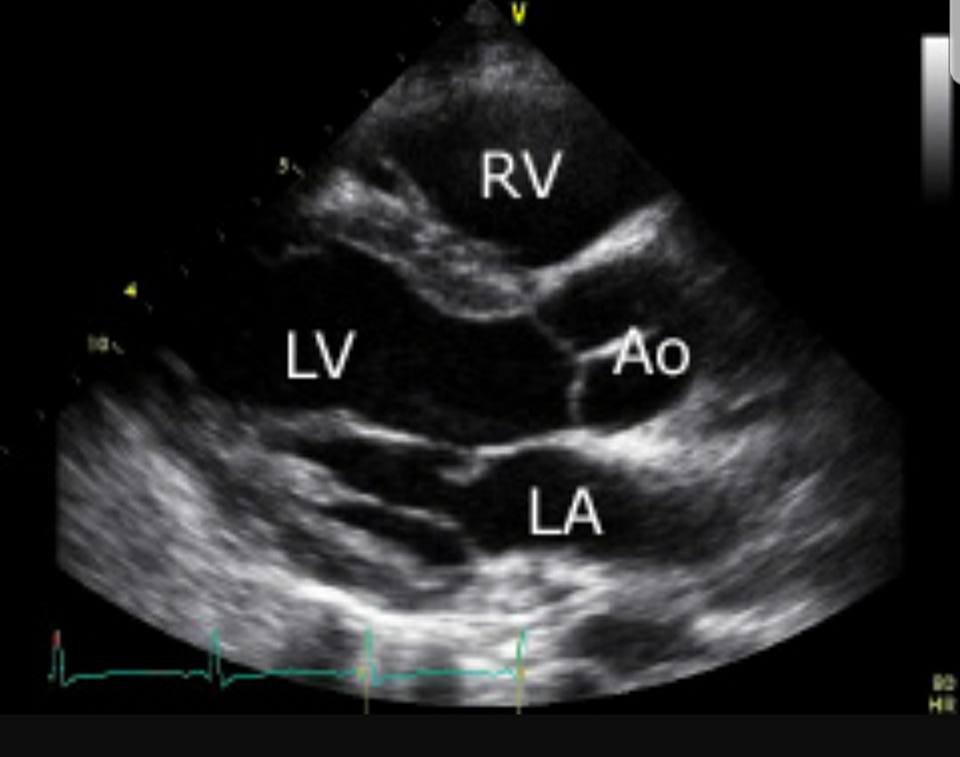 Emergency Echo - Here's a great set of labelled echo views... | Facebook
