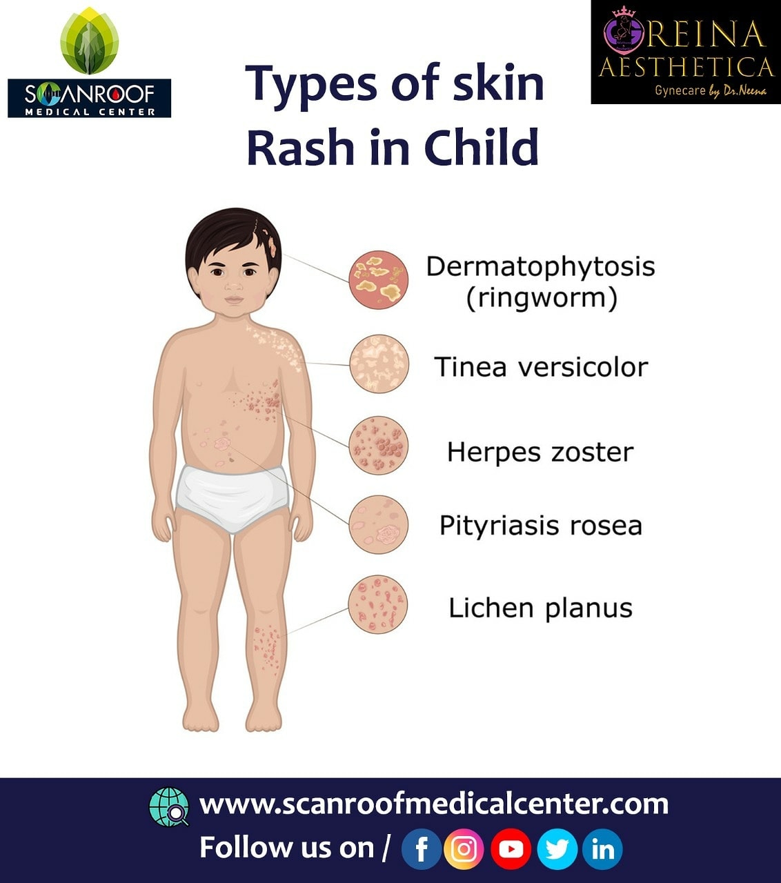 The most common causes of rashes... - Scanroof Medical Center