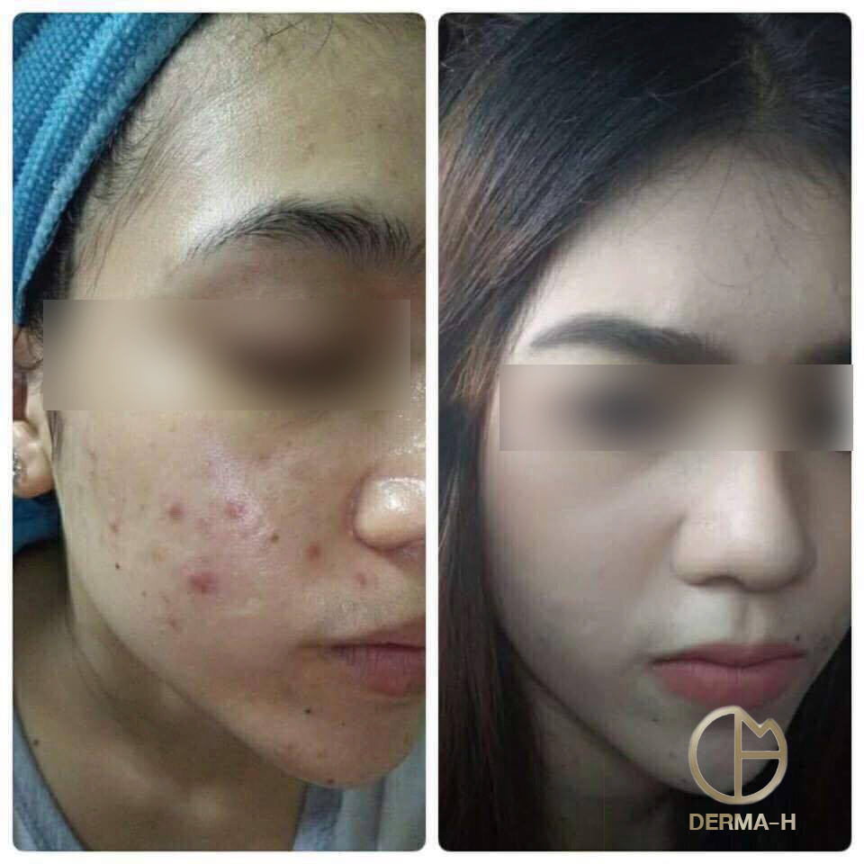 Derma-H - ผิวจะสวย อยู่ที่คุณดูแล 💕 อยากมีผิวสวยสุขภาพดี ลองเปลี่ยนครีม ...