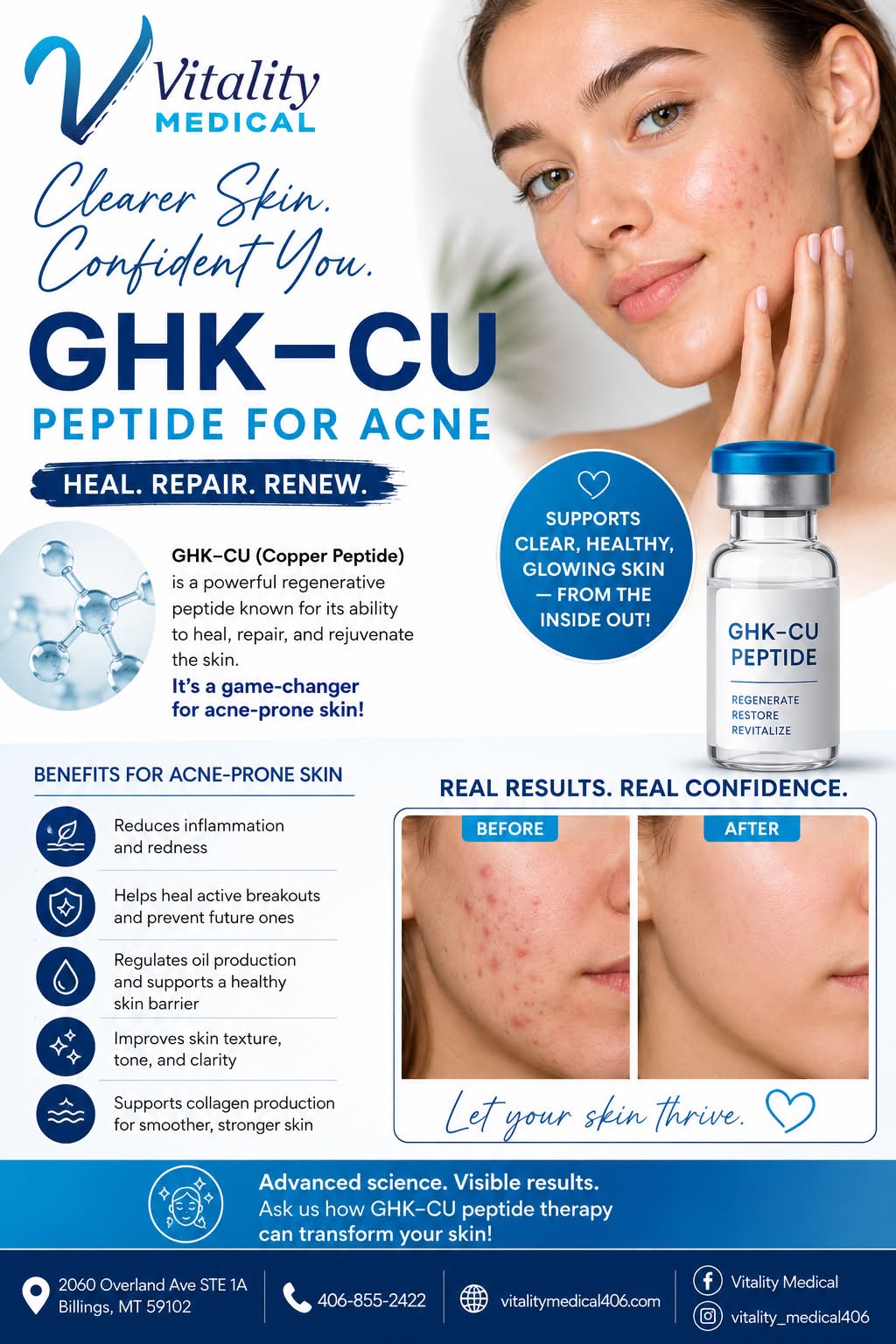 ghk-cu peptide skincare benefits therapy for acne treatment and skin rejuvenation BPC-157 and other peptides RPD gun accessories Vial Size:30ml Vial