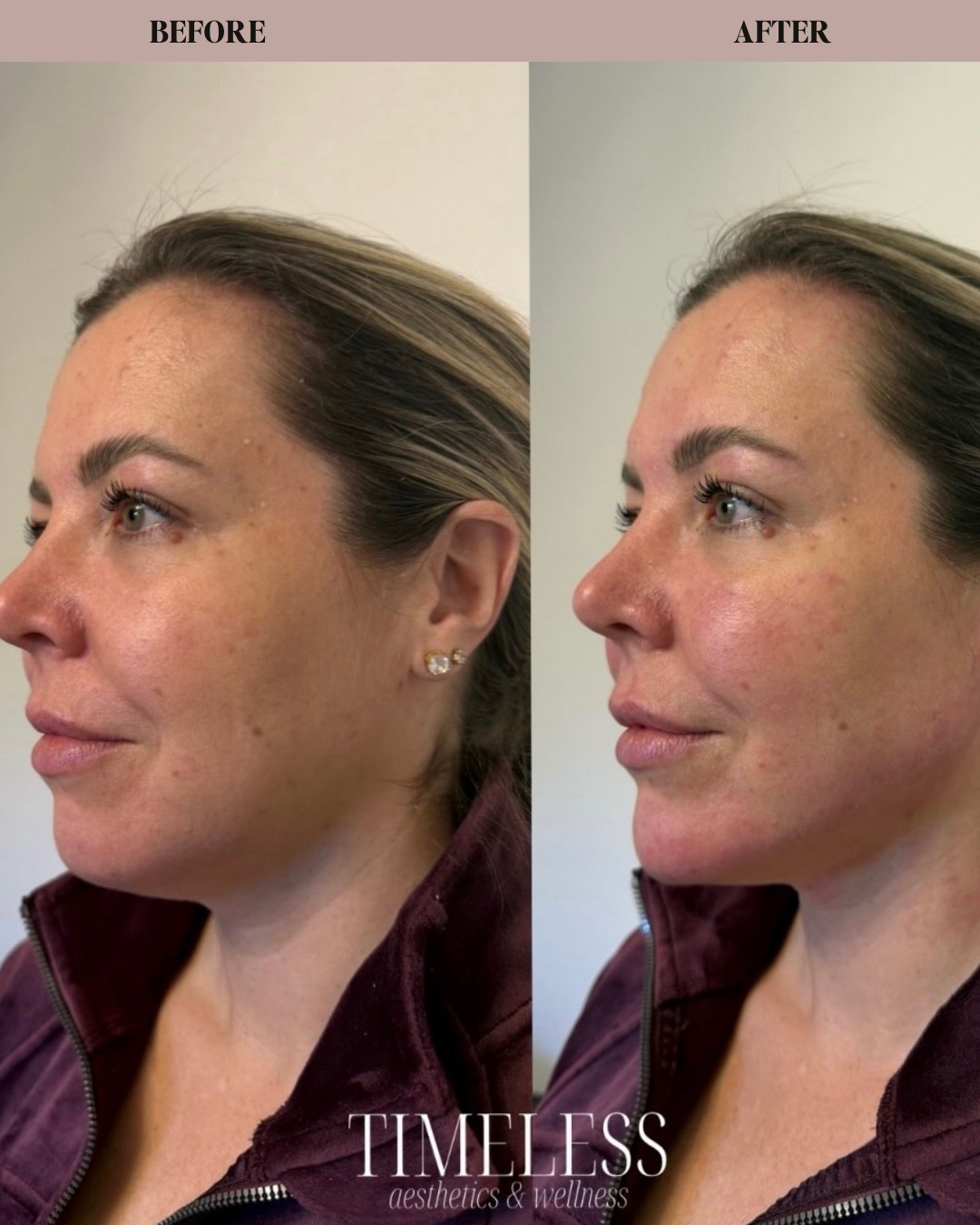 does ghk cu improve jawline Unlocking the Secrets of GHK-Cu: The Revolutionary Peptide for Youthfu GHK-Cu Peptide Injection in Dubai