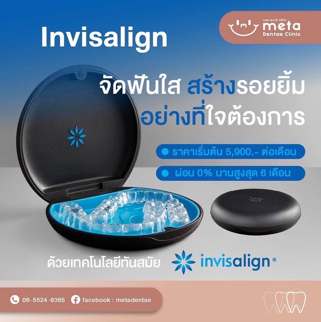 Invisalign Go... - Meta Dentae Clinic