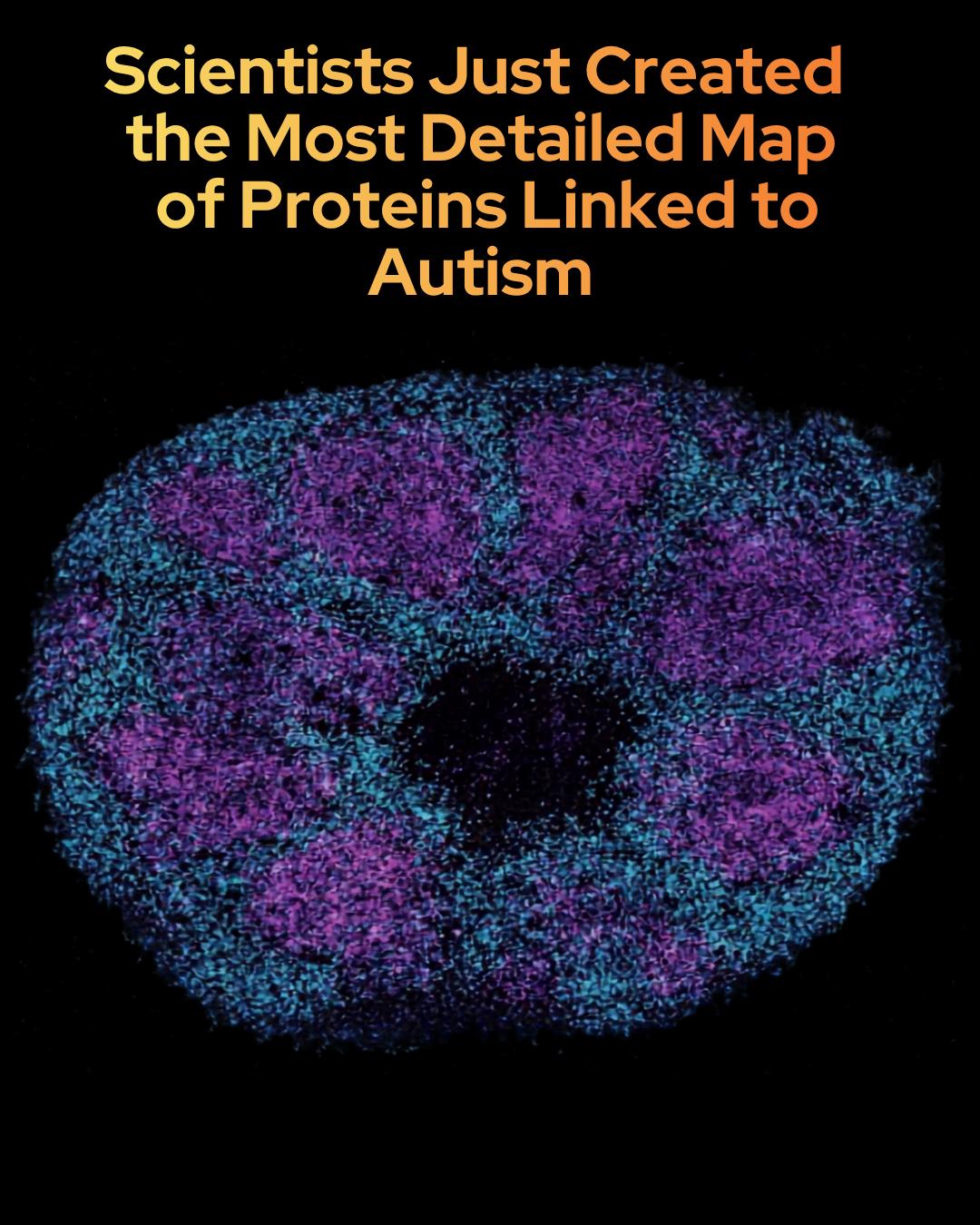 glutathione protocol reddit Scientists have built the most detailed map yet of the proteins tied to autism spectrum disorder—tracking over 1,800 proteins that interact with 100 gene variants. The findings suggest that autism's hundreds of How IV Therapy Can