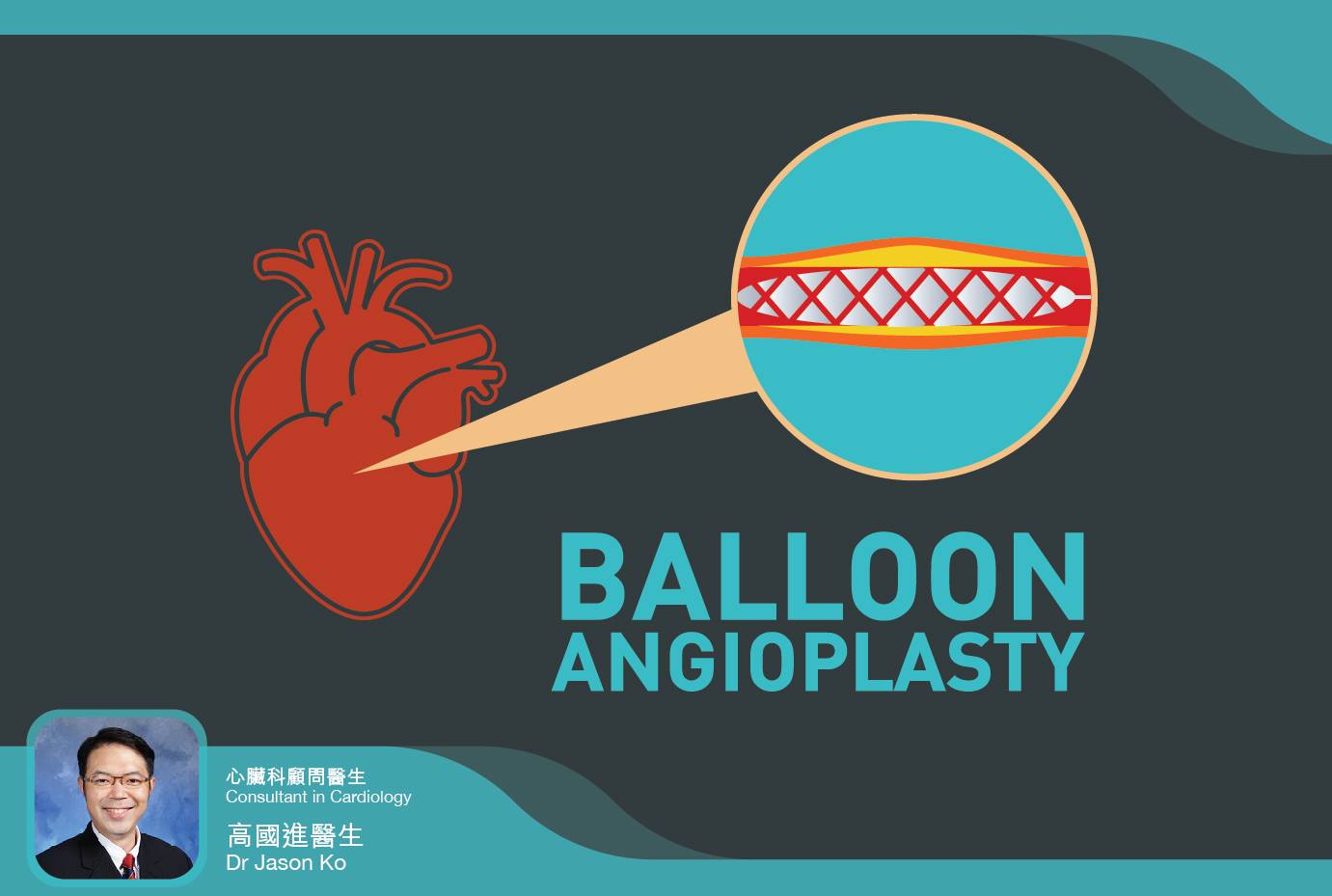 【通完波仔之後，個心會唔會「好番晒」？】 Recovering From Angioplasty and Stent Insertion #通 ...