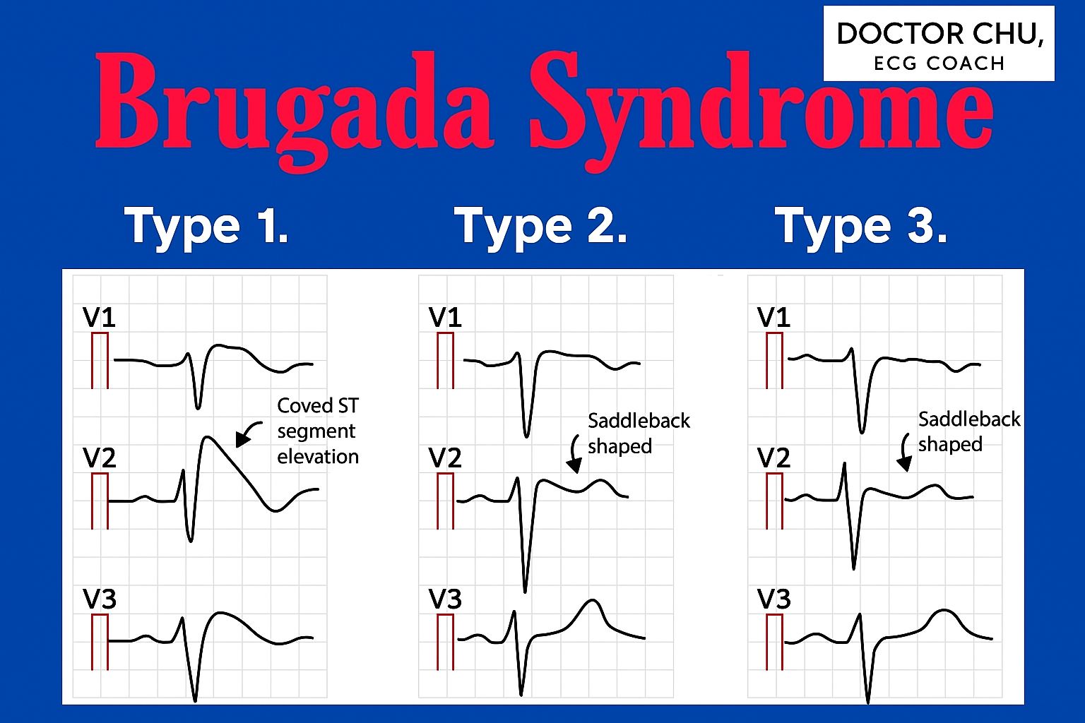 Doctor Chu... - Doctor Chu . Khóa Học Điện Tâm Đồ ECG Online