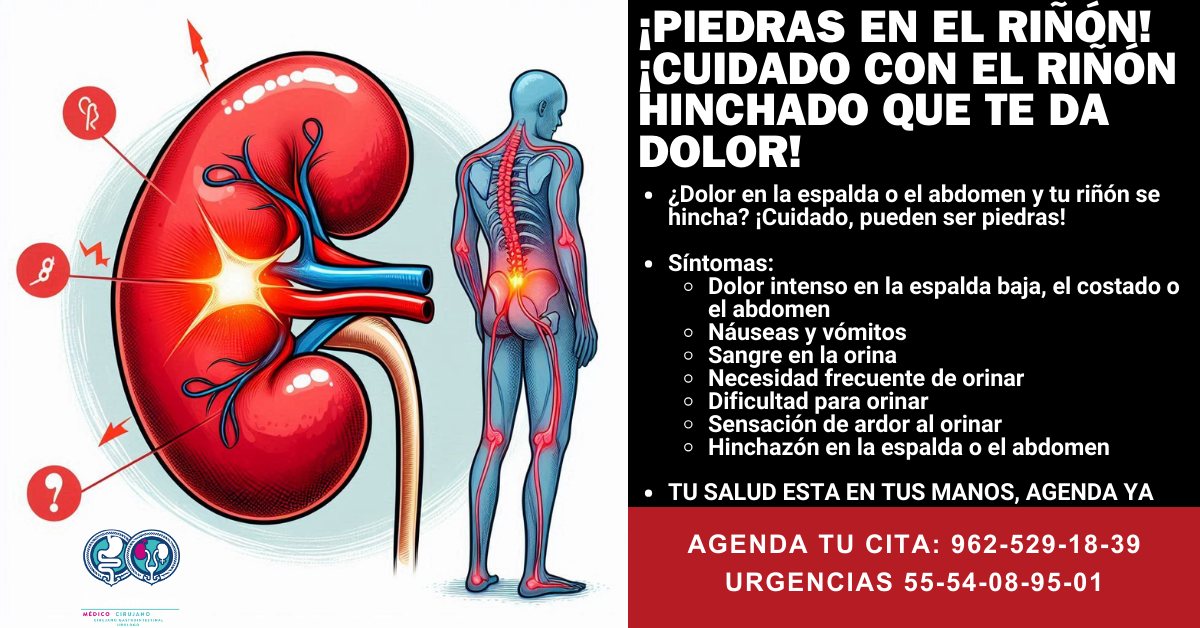 Jovan - ¿Dolor en la espalda o el abdomen y tu riñón se hincha ...