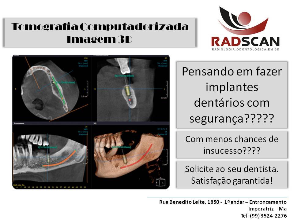Radscan - Radiologia Odontológica em 3D | Imperatriz MA