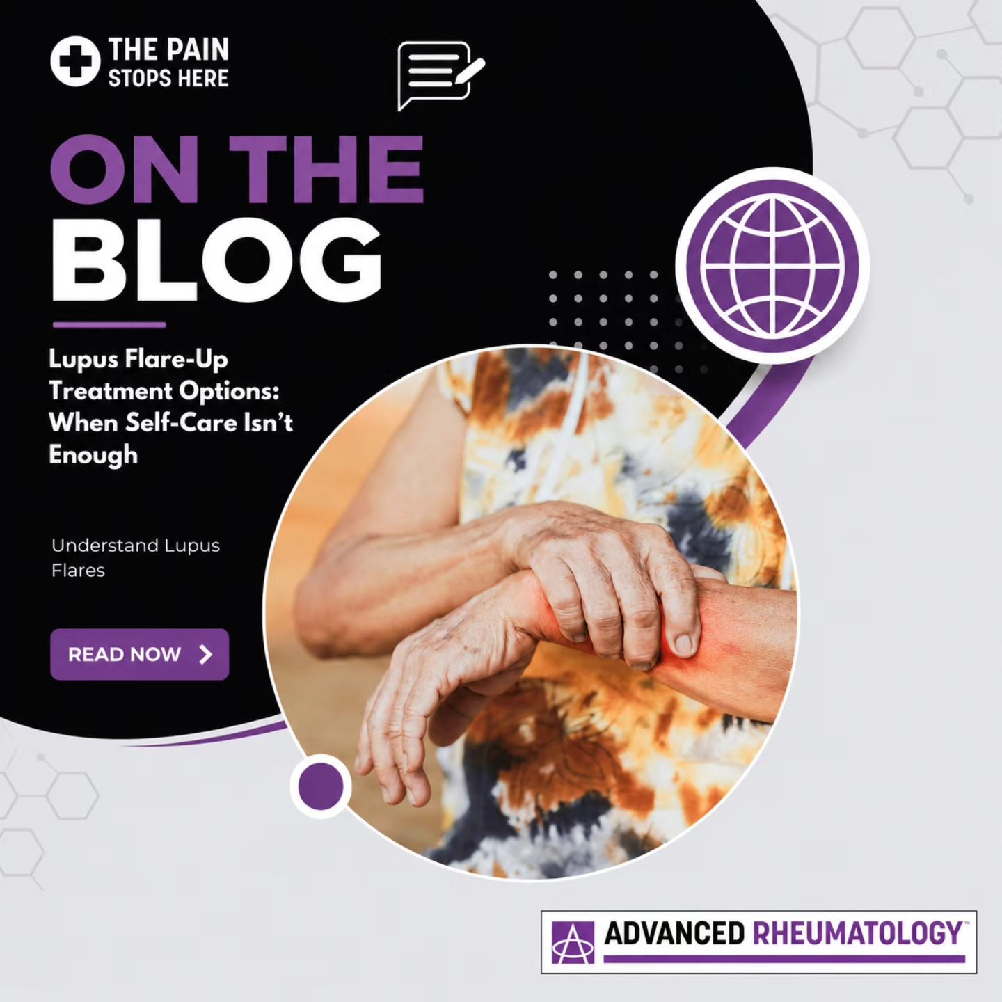 can getting b12 injections cause lupus flare flare-up treatment options beyond self-care EOFY Vitamin B12 Injections for Supply Duration:3 months supply