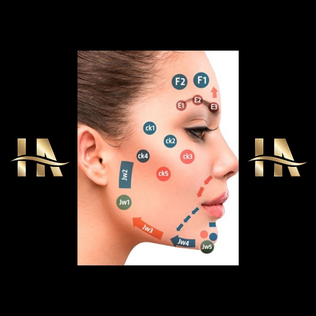 > MD Codes for Fillers