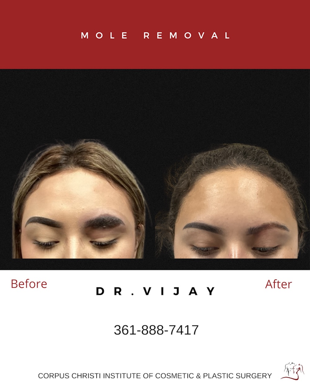 vijaya bpc 157 reviews BPC-157 Benefits, Dosage & Before/After Results Pharmaceutics | January 2025 Corpus Christi Plastic Surgery and